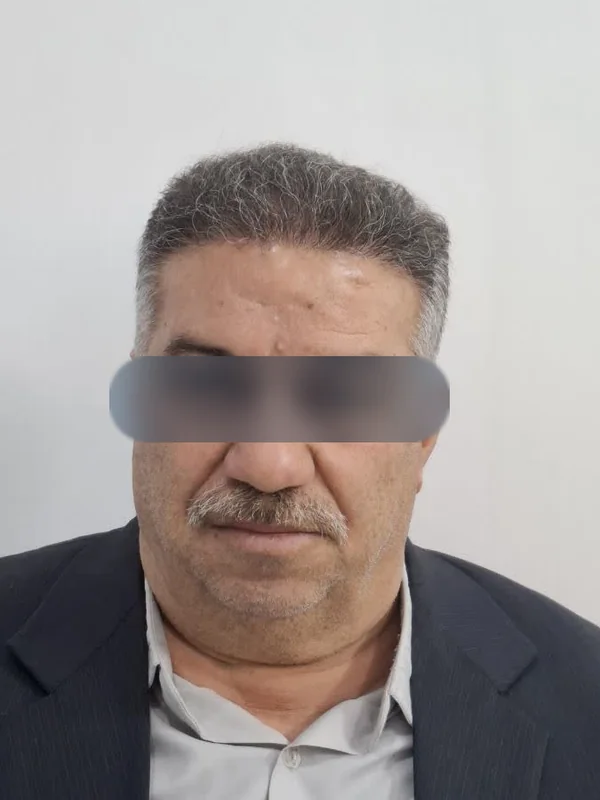 بعد از کاشت مو، مراجع کلینیک موسی‌زاده