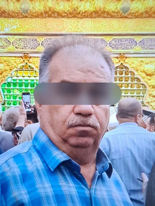 قبل از کاشت مو، مراجع کلینیک موسیزاده